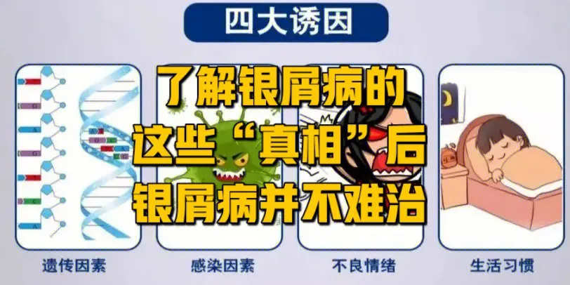 治疗银屑病医院哪家好？银屑病患者会并发哪些疾病？